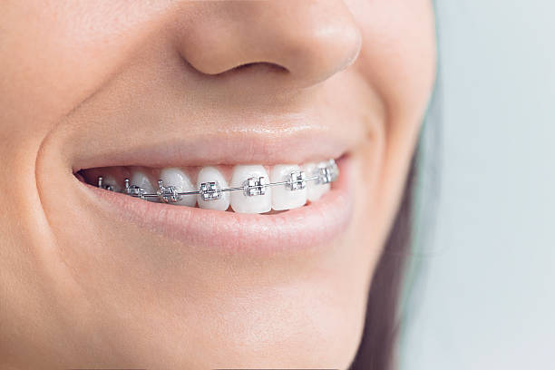 Best Veneers and Lumineers  in Washington Mills, NY